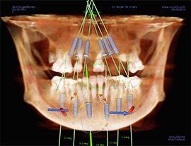 Computer-Guided-Surgery-01