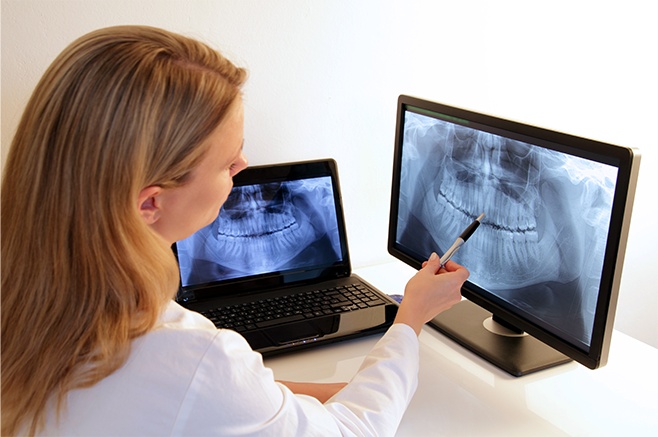 dental-x-rays