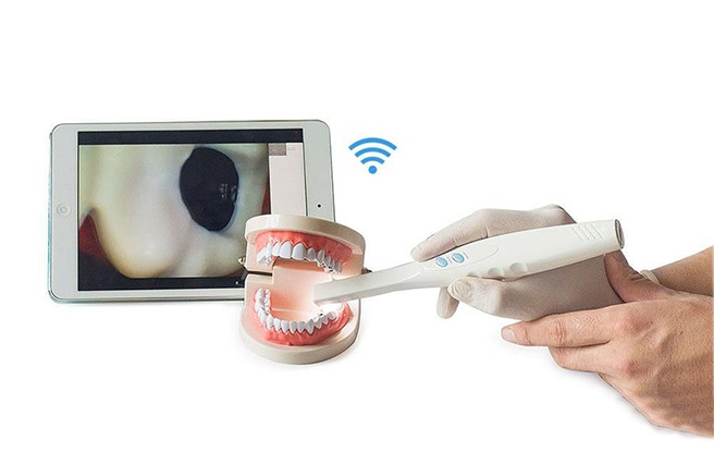 intra-oral-camera