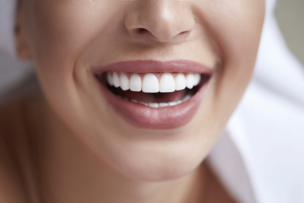Portrait of beautiful white teeth Portrait of beautiful white teeth