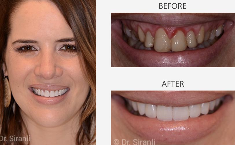 Photo of a happy Siranli Dental patient