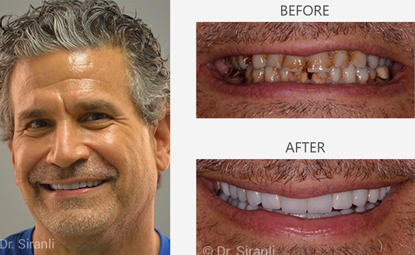 Photo of a happy Siranli Dental patient