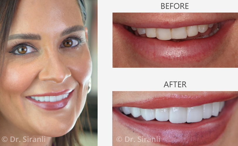 Photo of a happy Siranli Dental patient