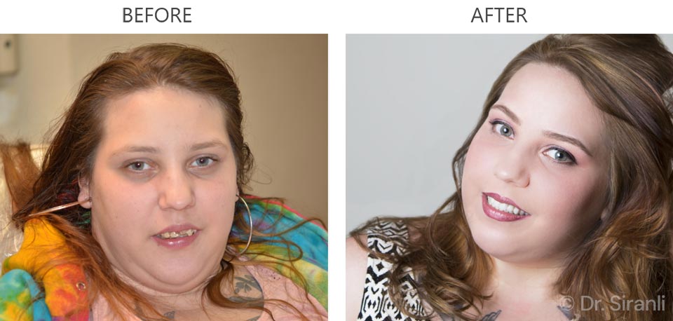 Photo of a happy Siranli Dental patient