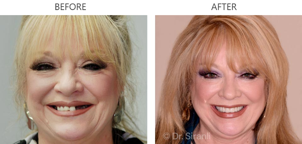 Photo of a happy Siranli Dental patient
