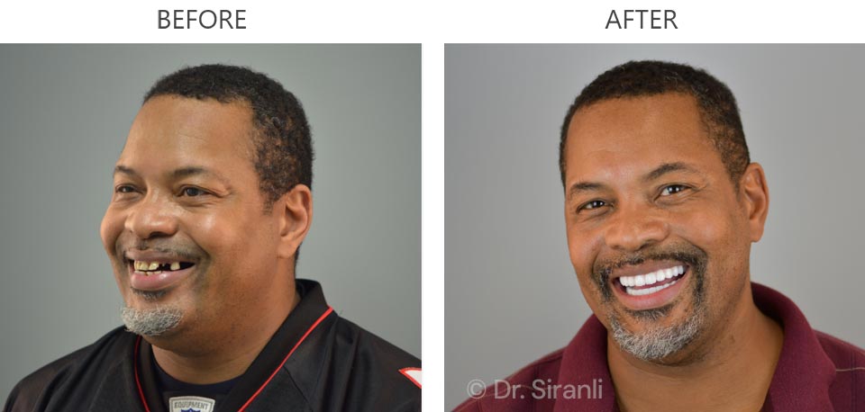 Photo of a happy Siranli Dental patient