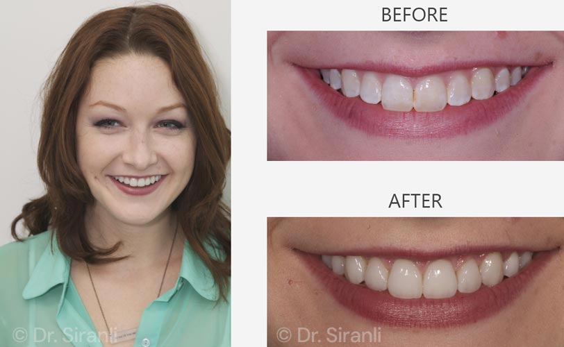 Photo of a happy Siranli Dental patient